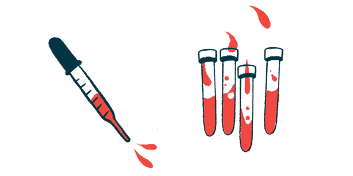 A dropper squirting blood is shown next to four half-filled vials.